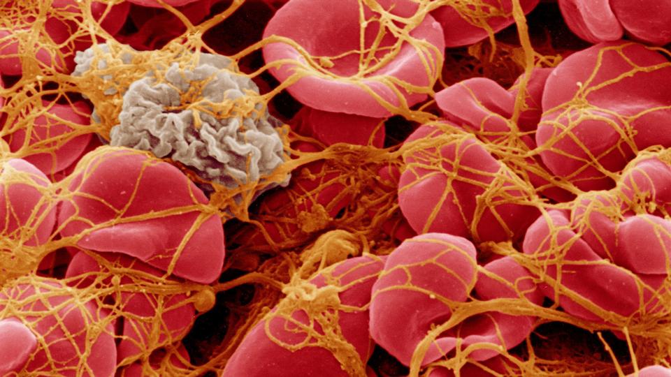 Red blood cells caught in a clot